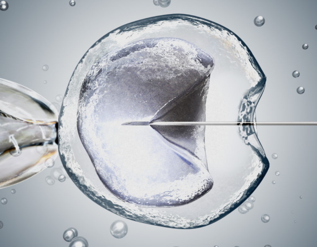 IVF